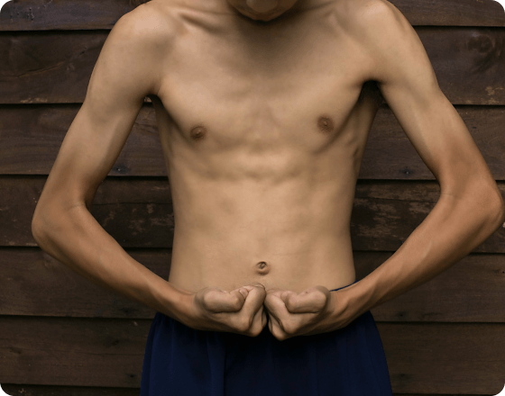 Muscle Loss